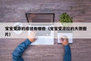 宝宝受凉的症状有哪些（宝宝受凉拉的大便图片）